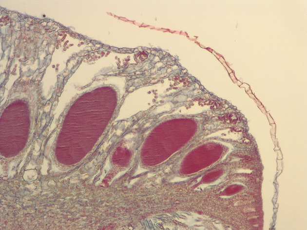 Liverwort Antheridia CS Slides - Liverwort Antheridia CS 03 100X